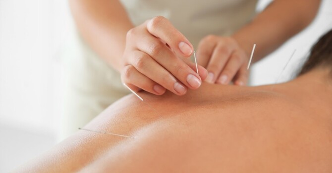 Acupuncture Meridians and Qi Explained image