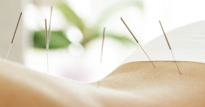 Acupuncture Meridians and Qi