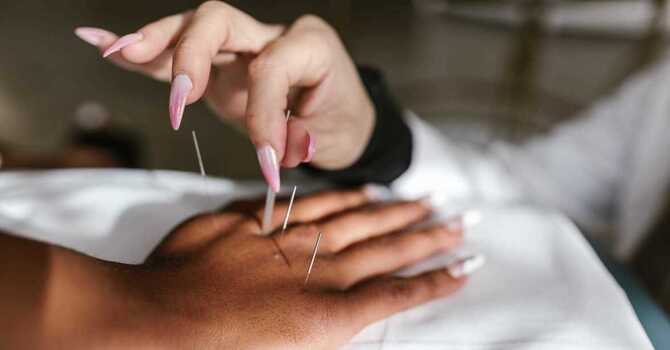 Does Acupuncture Hurt? image